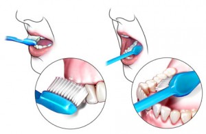 Szczotkowanie zębów Dental Medicenter