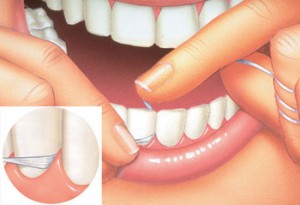 nitkowania ząbów Dental Medicenter
