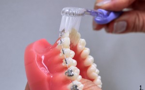 metoda_bassa1_DentalMedicenter_WCisowska