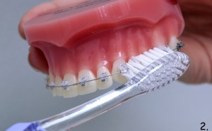 metoda_bassa2_DentalMedicenter_WCisowska