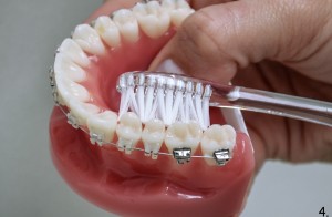 metoda_roll4_DentalMedicenter_WCisowska