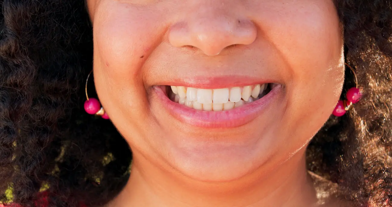 Ropień okołozębowy